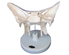 Amplified Alar Bone