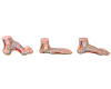 Normal, Flat, Arched Foot