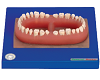 Set of teeth of an Adult