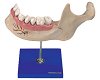 Lower Jaw of 18-year-old