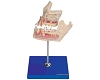 Pathologic Tooth with Jaw