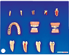 Dental Diseases Model