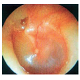 Advance Ear Inspection Model
